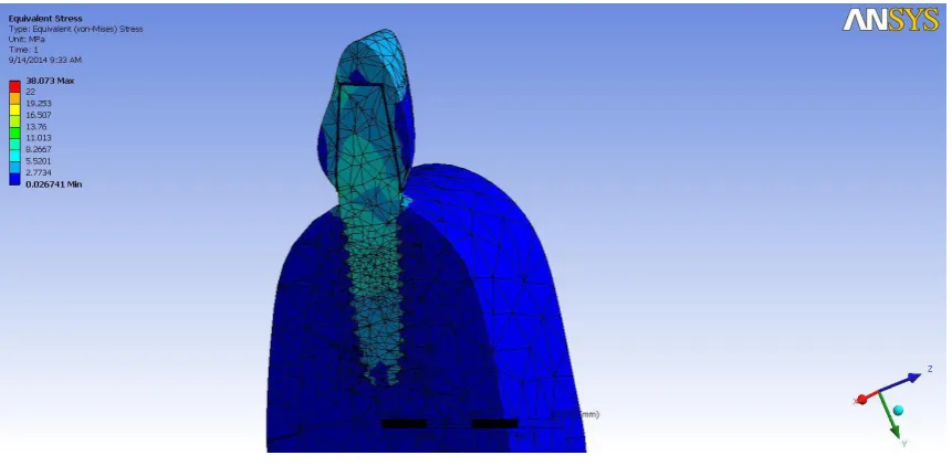 Fig: 02- Cross sectional view of single piece titanium implant  