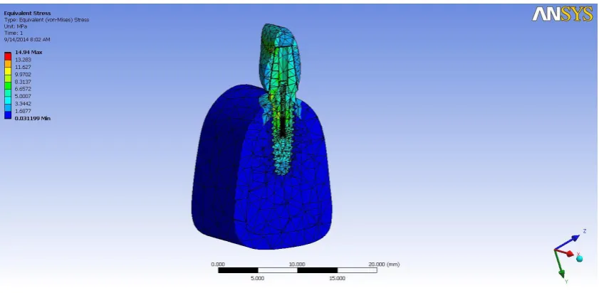 Fig: 04- Cross sectional view of two piece titanium implants 