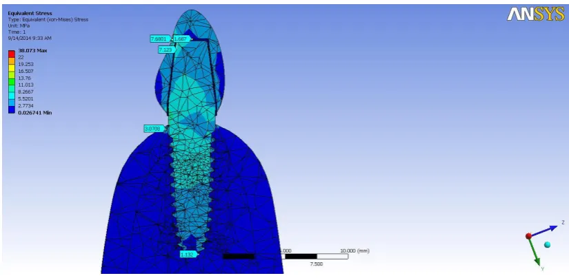 Fig: 11- Two dimensional view of Von mises stress Stress distribution  around 