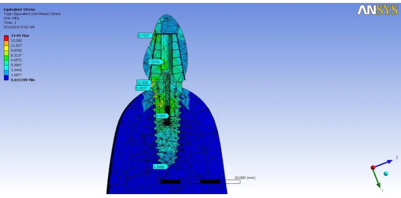 Fig: 13- Two dimensional view of Von mises stress distribution around two 