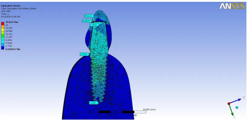 Fig: 15- Two dimensional view of single piece Zirconia implant 