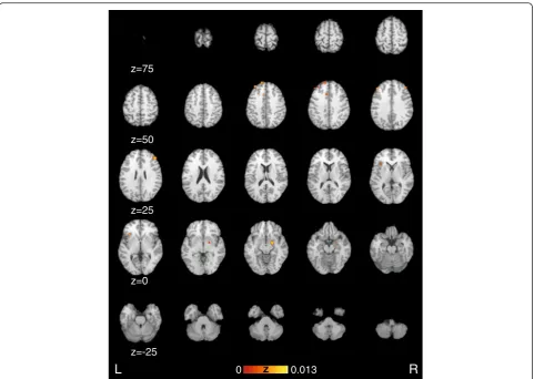 Fig. 3 Activation likelihood estimation maps showing significant clusters of all functional experiments and overlaid on the Colin Brain