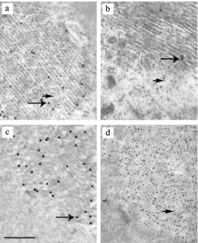 FIG. 3. Identiﬁcation of aggregates of HSV-1 and VZV scaffolding proteins by immunoelectron microscopy