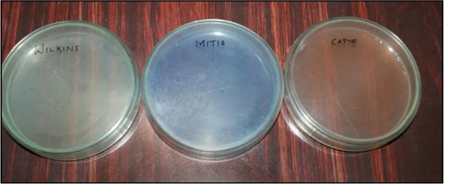 Figure 11- Pouring Selective Medium into the Plate 