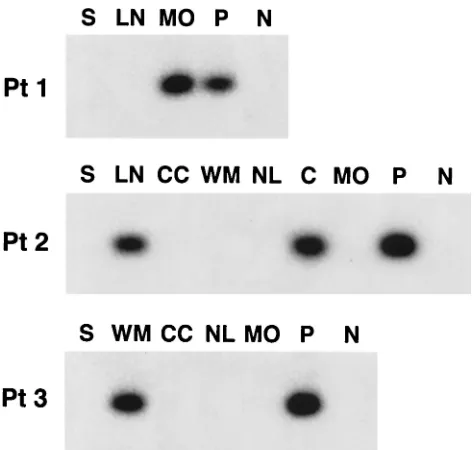 FIG. 1. Detection of negative-strand HCV RNA in various braintissue samples and lymph nodes (LN) in patients 1 to 3 (Pt 1 to Pt 3).