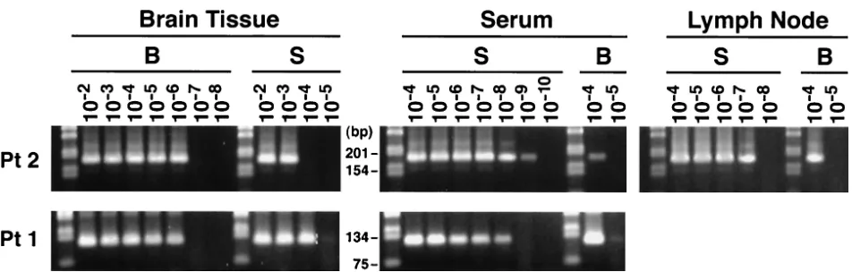 FIG. 7. Speciﬁc detection of serum-derived HCV sequences in brain tissue (A) and of brain-derived sequences in serum (B) in two patients withevidence of viral replication in the CNS