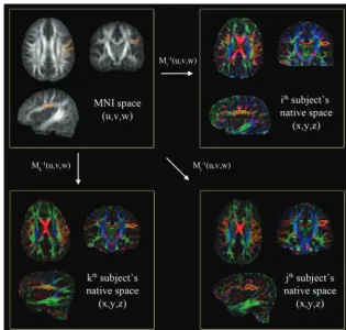 Fig 1. Automatic quantification of a CA map in the left AF region of native space. A single region of interest to enclose core voxels of the left AF (orange contour of the top left panel)is manually delineated on the MNI FA template (gray-scaled image in t