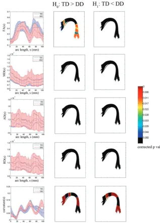 Fig 4. TBM group analysis of the left AF bundle by using a TD prototype fiber. For each arc-length coordinate (in millimeters), each subject’s mean FA, MD, AD, RD, and curvature valuessignificant difference on Hare computed for the left AF bundle