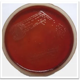 FIG. 1. NUTRIENT AGAR PLATE SHOWING GREEN PIGMENTED COLONIES 