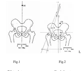 fig.2. Abductor muscles of the standing leg should exert downward pull 