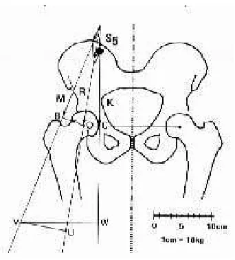 Fig.3 Waddle hip Biomechanics 
