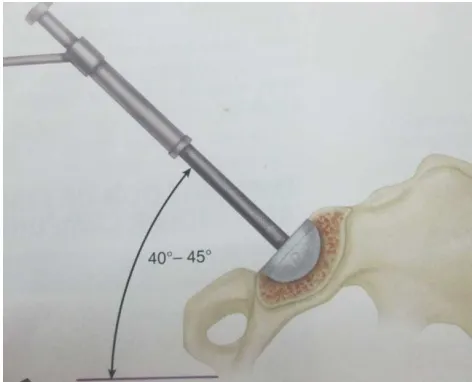 Fig.2.angle of inclination 