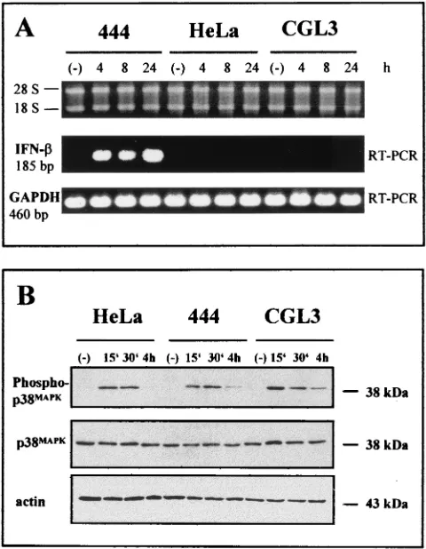 FIG. 1.Selective IFN-ing and protein transfer were conﬁrmed by incubating the upper ﬁlteror a phosphorylation-unspeciﬁc (p38HPV18-positive cells, showing intactness of the MAPK pathway