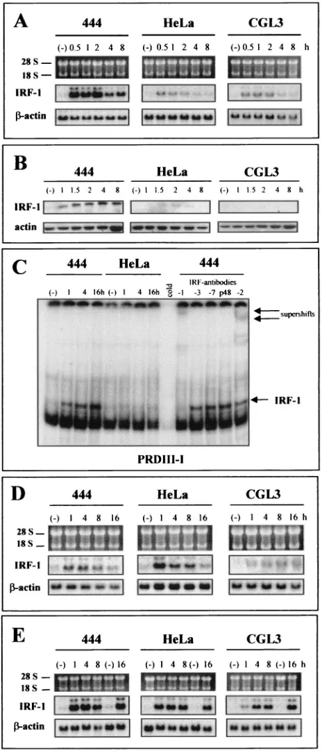 FIG. 6. Selective IRF-1 induction by TNF-�HPV18-positive cells. (A) Transcriptional analysis of IRF-1 afterTNF-separated on 1% agarose gels