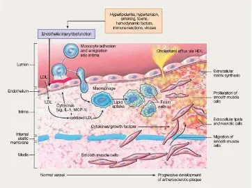Figure 3.2: Sequence of cellular interactions in atherosclerosis 