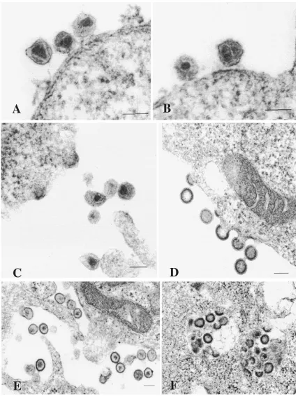 FIG. 6. Ultra-thin-section electron microscopic analysis of HEK 293 EBNA cells transfected with chimeric TE proviruses