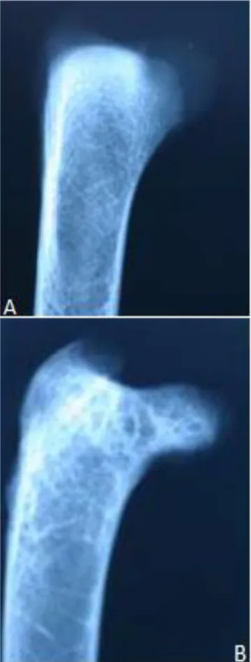 Figure  6.  Lateromedial  view  of  the  proximal  end  of  femur.  A. 