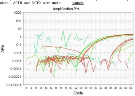 Figure 2: An amplification plot showing the amplification detected in the reverse transcription blanks and negative controls