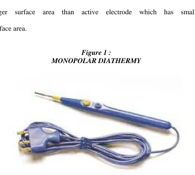 Figure 1 :  MONOPOLAR DIATHERMY 