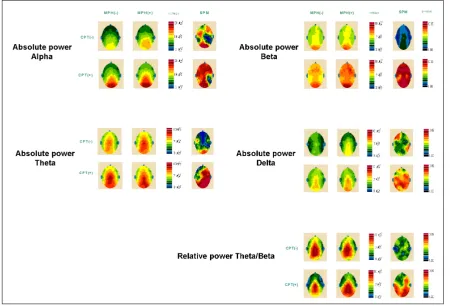 Fig. 2. Average topographic maps of Z-transformed monopolar absolute power of 4 bands and relative power ofT-statistical probability map(SPM) means that the darker the red color, the more statistically significant theθ β/