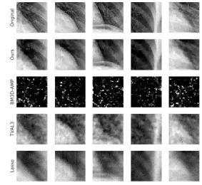 Figure A.4: Reconstruction results on x-ray images for m = 500, 1000 measurements respectively (of n = 65536 pixels)
