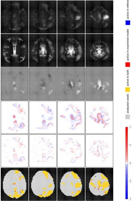 Figure 1: Summary of results from the iMRF f lex model in comparison to iMRF 0 (selected brain slices: 21, 23, 25, 27).