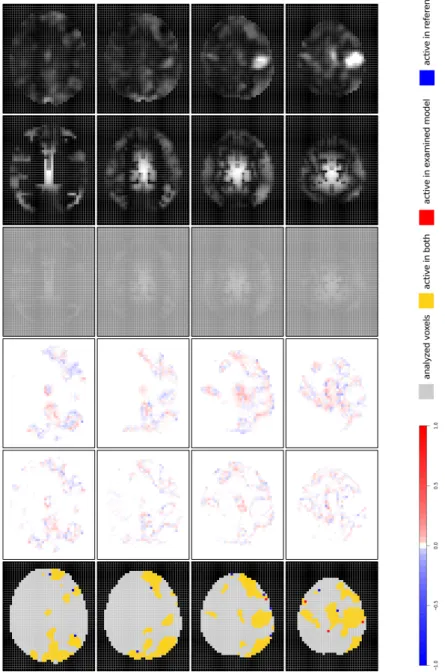 Figure 2: Summary of results from the iMRF glob model in comparison to iMRF 0 (selected brain slices: 21, 23, 25, 27).