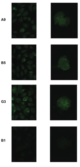 Figure 2. Sequences of IgM anti-DNA anti-bodies. The sequences of the variablegenes of three mutated antibodies werecompared with their germline counter-parts