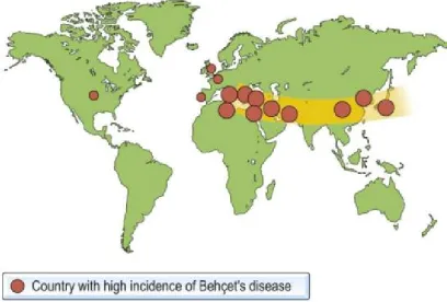 Fig.1 : Showing countries with the highest incidence of Behçet’s disease 