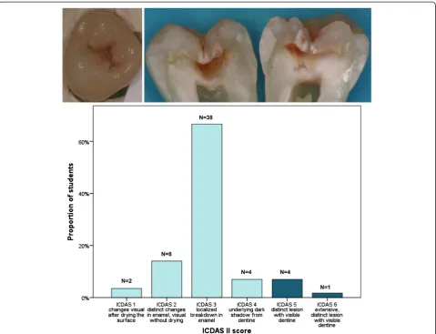 Figure 2 An example of a caries lesion which surprised the students by its true histological depth