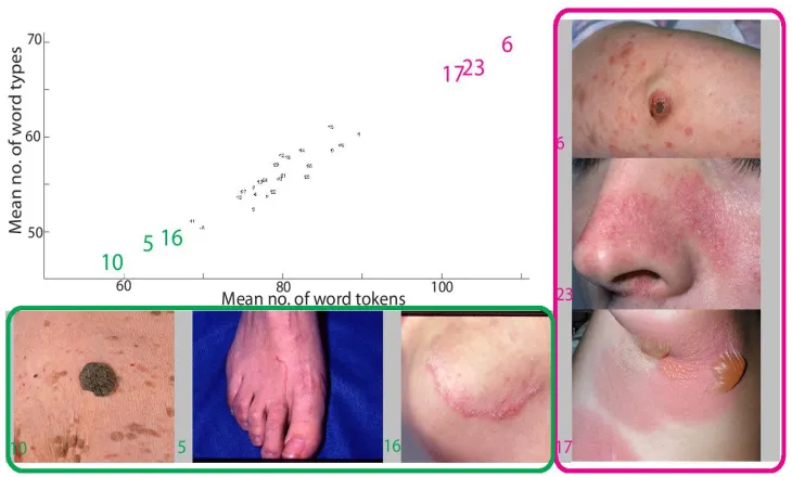 Figure 3.3: Scatter plot showing mean word types vs. mean word tokens for each imageacross all observers in the derm ii dataset