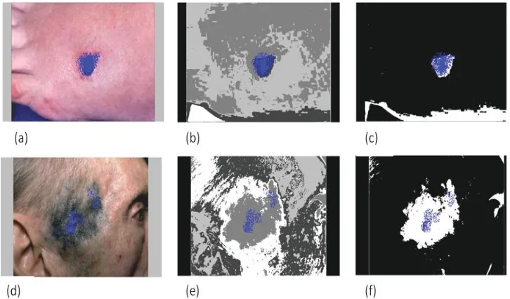 Figure 3.12: Panels (a, d) ﬁxations (blue dots) overlaid on original images. Panels (b,e) ﬁxations (blue dots) overlaid on the segmentation maps of panel (a) and panel (d)respectively