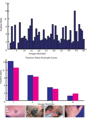 Figure 3.13: (a) Graph showing the ﬁxation ratio for every image; (b) Comparison ofﬁxation ratio generated using the binary (non-foveal) and grayscale (foveal) ﬁxation mapfor four example images.