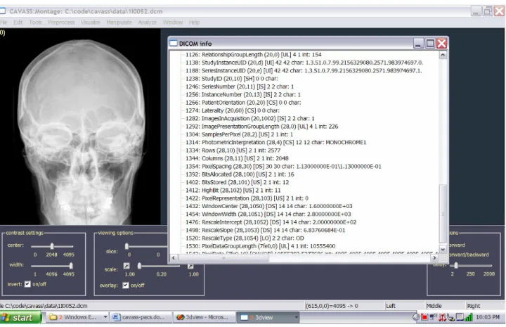 Fig. 1.  An example of the CAVASS DICOM header browser (sample DICOM image from  http://www.agfa.com/en/he/support/doc_library/dicom/adc_dicom_images/index.jsp)