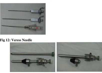Fig 13 : Hasson’s Cannula   