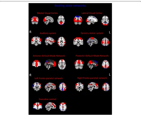 Figure 4 Resting state networks (RSNs) derived from Multiband data. Images represent group maps of 50 subjects