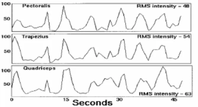 Fig:7  Shivering patterns 