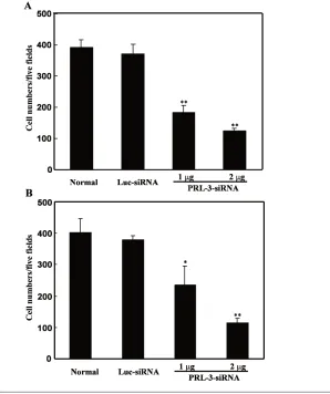 Figure 4. Effect of PRL-3 siRNA on migration and invasion of B16-BL6 melanoma cells. Inupper wells of Transwell inserts containing 8-coated with fibronectin (10 upper surface in the invasion assay