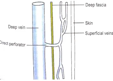 Figure 7: Direct Perforator Vein Figure 