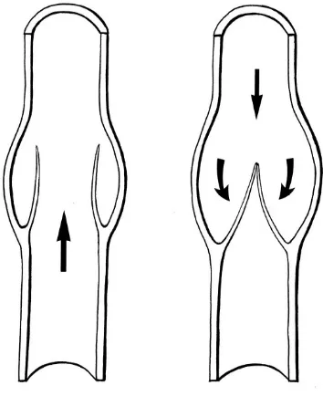 Figure 9: Venous Valve Structure 