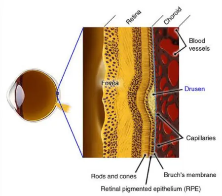 Figure 2. 6: Cross section of the retina, displaying the location of drusen. 1