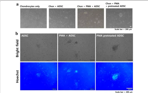 Fig. 4 Effect of PMA on the migration of ADSCs. After ADSCs reached approximately 70% confluence, wounds were created using a yellow pipette tip