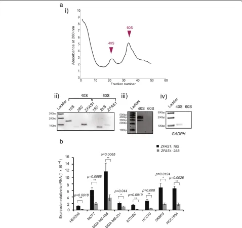 Fig. 4 ZFAS1products using primers as described in Fig. 1 from each peak, fractions 22 and 34.subunit distribution in the gradient