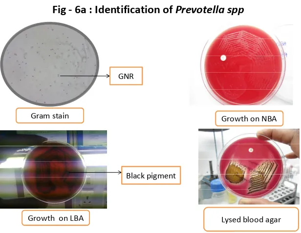 Fig - 6a : Identification of Prevotella spp