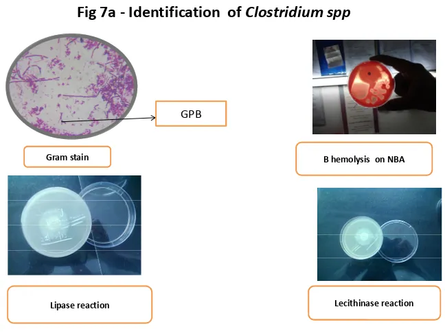 Fig 7a - Identification  of Clostridium spp