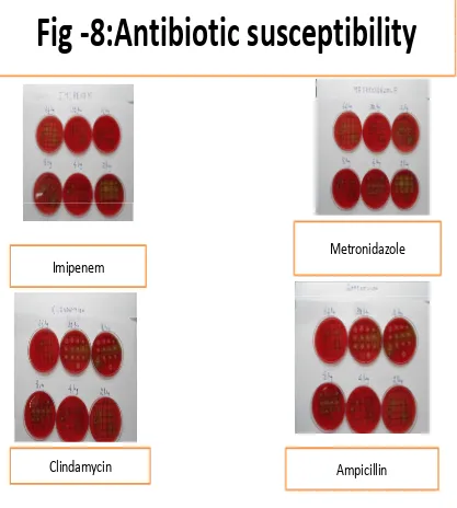Fig -8:Antibiotic susceptibility
