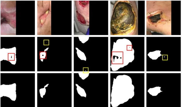 Figure 4. An illustration of the segmentation result and the post processing method. The first row illustrates  images in the testing dataset