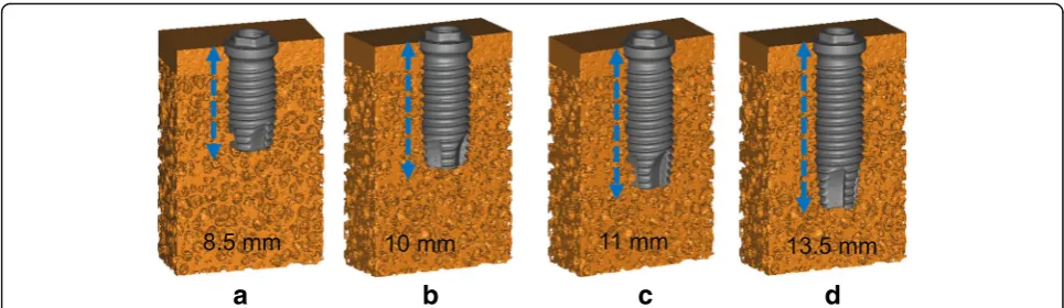 Fig. 3 3D models of artificial bone specimens with inserted implants. The lengths of the implants were (a) 8.5mm, (b) 10mm, (c) 11mm,and (d) 13.5mm
