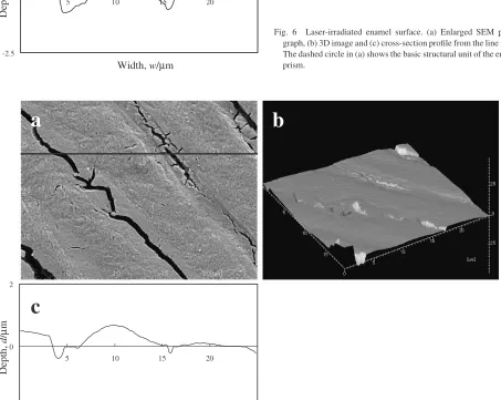 Fig. 6Laser-irradiated enamel surface. (a) Enlarged SEM photo-