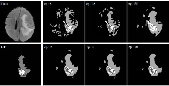 Figure 2.7: Validation results for Phase-1 (top) and Phase-2 (bottom) for different epochs
